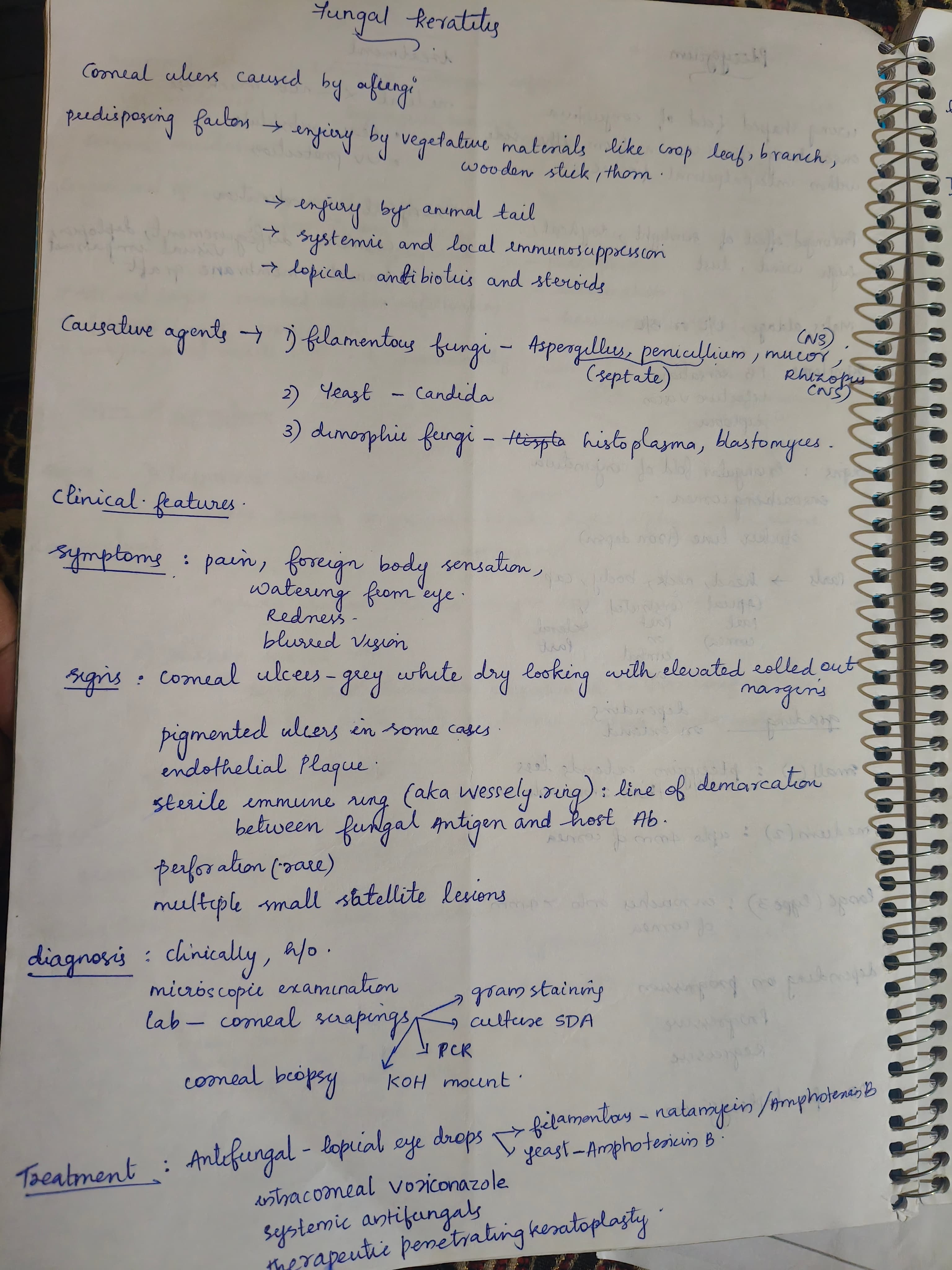 Fungal keratitis 