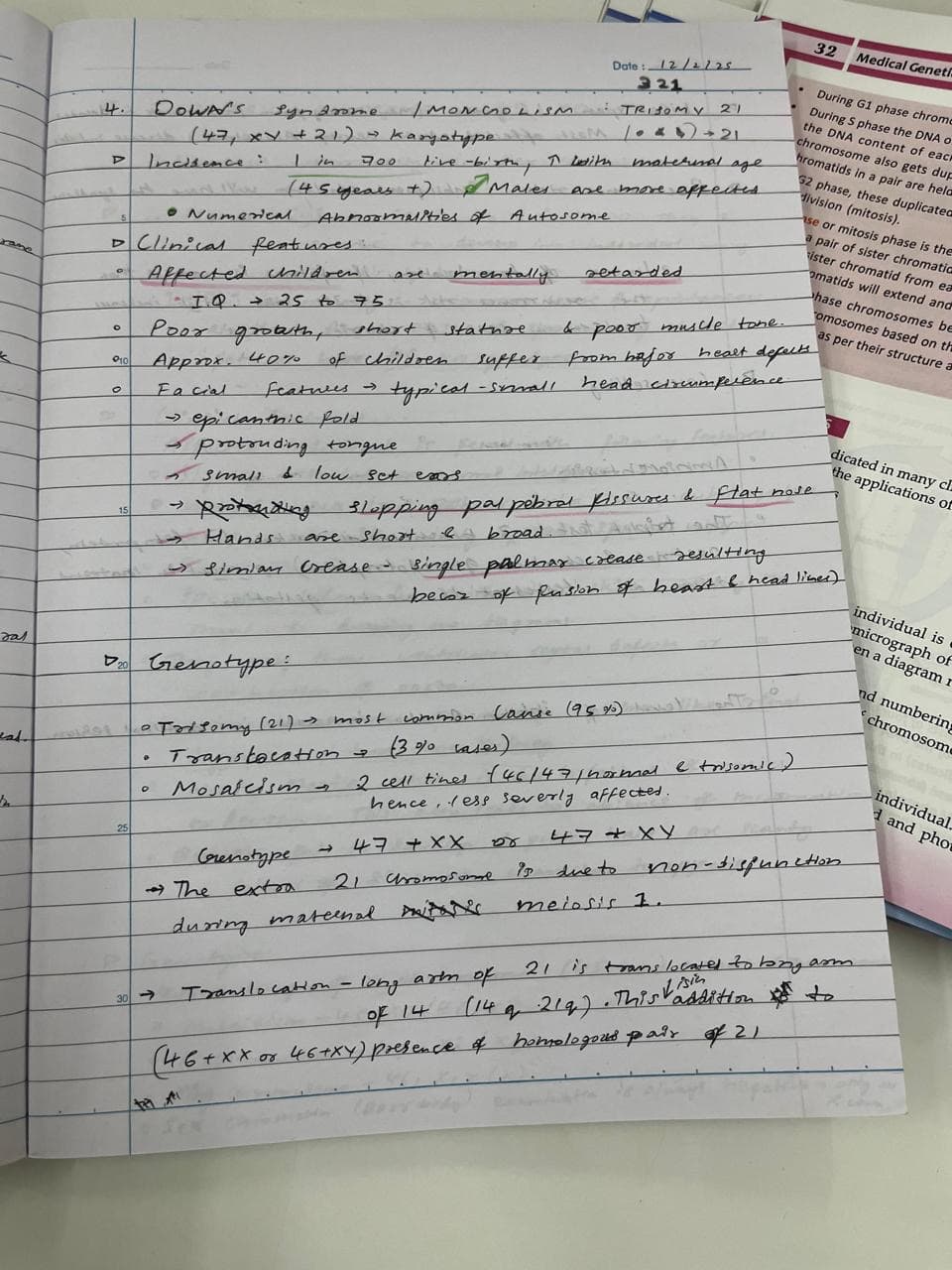 Down's Syndrome  - Slide 1