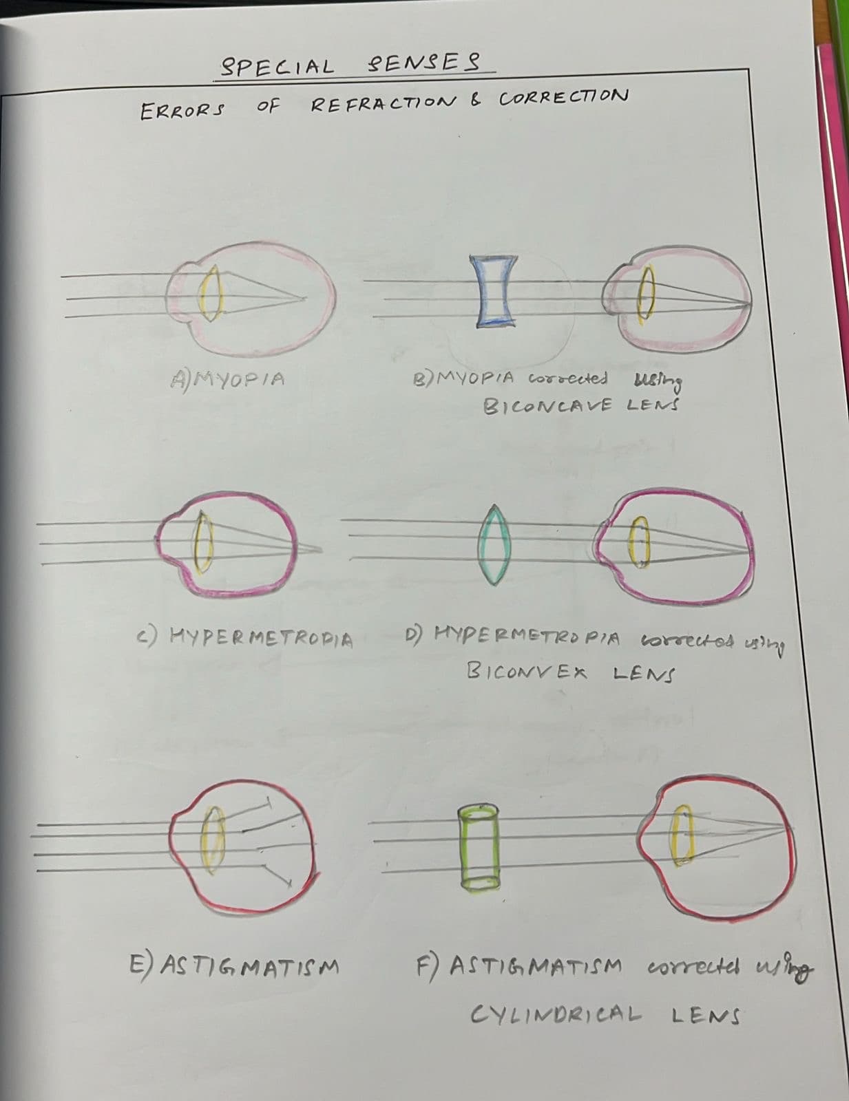 Errors of refraction and correction 
