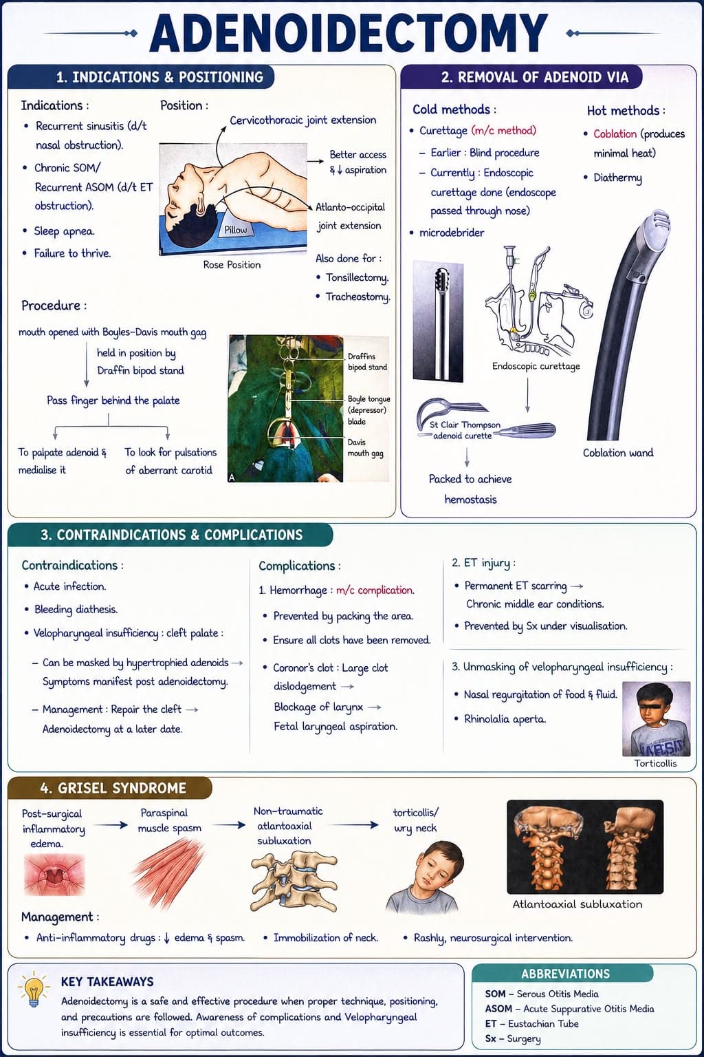 Adenoidectomy 