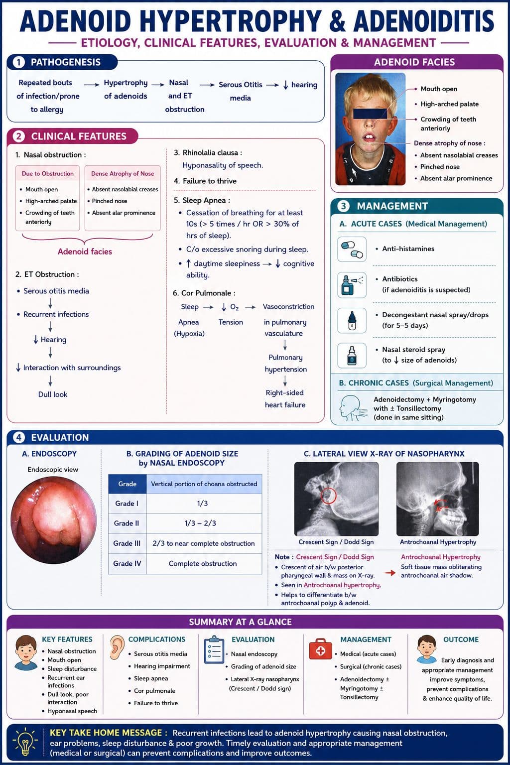 Adenoid hypertrophy 